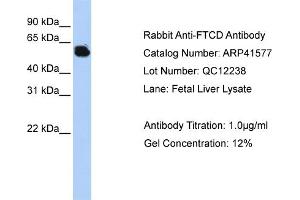 Western Blotting (WB) image for anti-Formiminotransferase Cyclodeaminase (FTCD) (Middle Region) antibody (ABIN2776888) (FTCD antibody  (Middle Region))