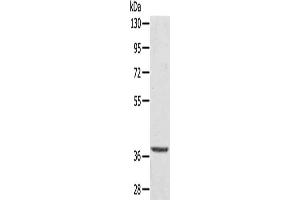 TBC1D21 antibody