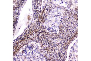 IHC analysis of Dynamin 1 using anti-Dynamin 1 antibody . (Dynamin 1 antibody  (AA 616-667))