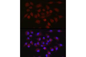 Immunofluorescence (IF) image for anti-Baculoviral IAP Repeat Containing 3 (BIRC3) (AA 1-180) antibody (ABIN1678920)