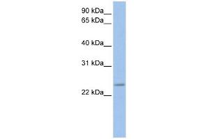FKBP3 antibody used at 1 ug/ml to detect target protein. (FKBP3 antibody  (C-Term))
