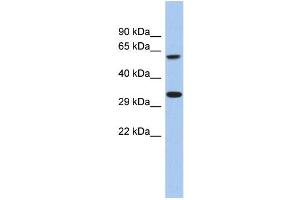 WB Suggested Anti-FAM26A Antibody Titration: 0.