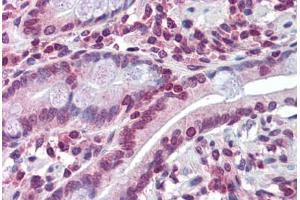 Immunohistochemistry (Formalin-fixed Paraffin-embedded Sections) (IHC (fp)) image for anti-ATP-Binding Cassette, Sub-Family C (CFTR/MRP), Member 8 (ABCC8) (N-Term) antibody (ABIN6747084)