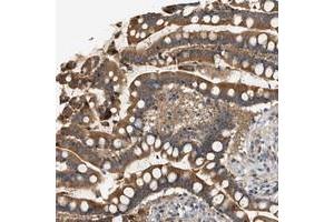 Immunohistochemical staining of human colon with WDR31 polyclonal antibody  strong cytoplasmic positivity in glandular cells at 1:200-1:500 dilution. (WDR31 antibody)
