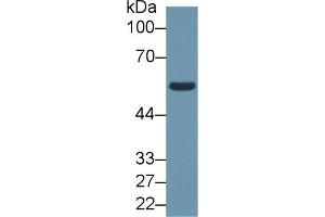 Detection of ALDH1B1 in Human HepG2 cell lysate using Polyclonal Antibody to Aldehyde Dehydrogenase 1 Family, Member B1 (ALDH1B1) (ALDH1B1 antibody  (AA 18-517))