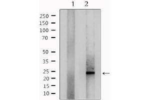 Western blot analysis of extracts from mouse lung, using RANBP1 Antibody. (RANBP1 antibody  (N-Term))
