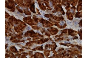 Immunoperoxidase of monoclonal antibody to SPINK1 on formalin-fixed paraffin-embedded human pancreas. (SPINK1 antibody  (AA 24-79))