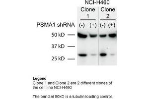 Sample Type: Human non-small cell lung cancer (NCI-460)Primary Dilution: 1:2000Secondary Dilution: 1:300050kDa band is a tubulin loading control band PSMA1 is strongly supported by BioGPS gene expression data to be expressed in Human NCI460 cells (PSMA1 antibody  (C-Term))