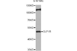 Western blot analysis of extracts of U-87MG cells, using GLP1R antibody (ABIN6292480) at 1:1000 dilution.