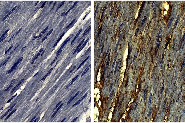 COL6 antibody
