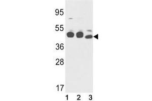 Western Blotting (WB) image for anti-Keratin 18 (KRT18) (AA 401-430) antibody (ABIN3031537)
