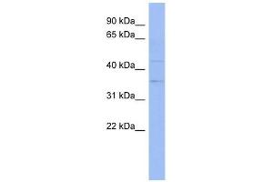 THOC3 antibody used at 1 ug/ml to detect target protein. (THO Complex 3 antibody  (Middle Region))