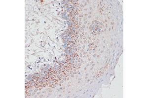 Immunohistochemistry of paraffin-embedded Human tonsil using Desmoplakin antibody (ABIN6134106, ABIN6139838, ABIN6139840 and ABIN6223548) at dilution of 1:100 (40x lens). (Desmoplakin antibody  (AA 1-100))