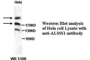 Image no. 1 for anti-Alstrom Syndrome 1 (ALMS1) antibody (ABIN1574631) (ALMS1 antibody)