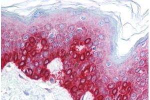 Human Skin (formalin-fixed, paraffin-embedded) stained with FOXA3 antibody ABIN214752 at 5 ug/ml followed by biotinylated goat anti-rabbit IgG secondary antibody ABIN481713, alkaline phosphatase-streptavidin and chromogen. (FOXA3 antibody  (AA 201-250))