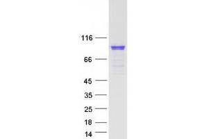 Validation with Western Blot (RPH3A Protein (Transcript Variant 2) (Myc-DYKDDDDK Tag))