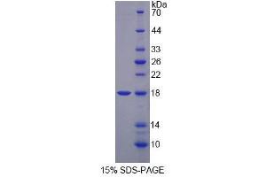 SDS-PAGE analysis of Mouse MARS Protein. (MARS Protein)