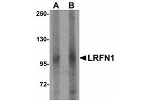 Image no. 1 for anti-Leucine Rich Repeat and Fibronectin Type III Domain Containing 1 (LRFN1) (C-Term) antibody (ABIN478048)