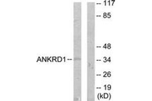Western blot analysis of extracts from COLO205 cells, using ANKRD1 Antibody. (ANKRD1 antibody  (AA 231-280))