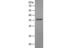 GBA Protein (AA 362-512) (His-IF2DI Tag)