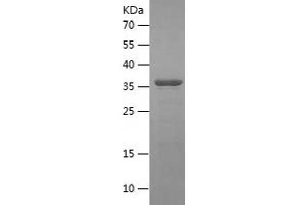 GBA Protein (AA 362-512) (His-IF2DI Tag)