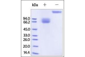 Human Growth Hormone R, Fc Tag on SDS-PAGE under reducing (R) and no-reducing (NR) conditions. (Growth Hormone Receptor Protein (GHR) (AA 27-264) (Fc Tag))