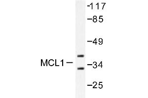 Image no. 1 for anti-Induced Myeloid Leukemia Cell Differentiation Protein Mcl-1 (MCL1) antibody (ABIN265513) (MCL-1 antibody)