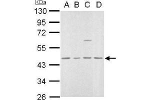 WB Image MVD antibody detects MVD protein by Western blot analysis.