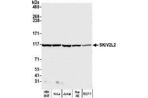 Western Blotting (WB) image for anti-Superkiller Viralicidic Activity 2-Like 2 (SKIV2L2) (AA 100-150) antibody (ABIN7449416)