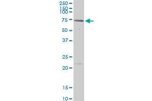 MEN1 MaxPab polyclonal antibody. (Menin antibody  (AA 1-575))