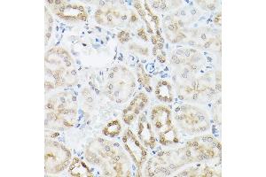 Immunohistochemistry of paraffin-embedded mouse kidney using UBQLN2 Rabbit pAb (ABIN6127815, ABIN6149859, ABIN6149860 and ABIN6225041) at dilution of 1:250 (40x lens). (Ubiquilin 2 antibody  (AA 1-150))