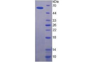 SDS-PAGE analysis of Human P-glycoprotein 1 Protein. (Permeability Glycoprotein Protein)