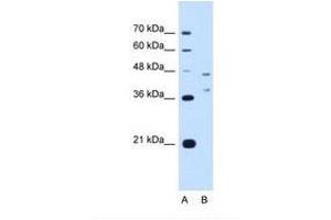 Image no. 1 for anti-Ecotropic Viral Integration Site 2B (EVI2B) (AA 251-300) antibody (ABIN321145) (EVI2B antibody  (AA 251-300))