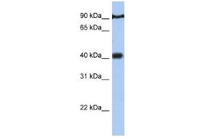 PTOV1 antibody  (N-Term)