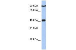 WB Suggested Anti-PTOV1 Antibody Titration:  0.