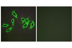 Immunofluorescence analysis of HepG2 cells, using Heparin Cofactor II antibody.