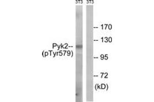 Western blot analysis of extracts from NIH-3T3 cells, using PYK2 (Phospho-Tyr579) Antibody. (PTK2B antibody  (pTyr579))