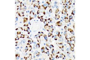 Immunohistochemistry of paraffin-embedded human liver using A-RAF Rabbit mAb (ABIN7271263) at dilution of 1:100 (40x lens). (ARAF antibody)