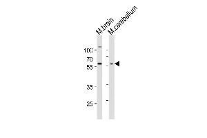 Western blot analysis of lysates from mouse brain, mouse cerebellum tissue lysate (from left to right), using GLD2 Antibody (N-term) (ABIN651284 and ABIN2840170).