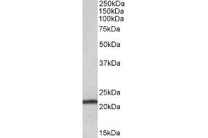 ABIN2560453 (0. (TMEM205 antibody  (AA 137-146))