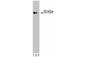 Western blot analysis of TopBP1 on a Jurkat cell lysate (Human T-cell leukemia, ATCC TIB-152). (TOPBP1 antibody  (AA 204-416))