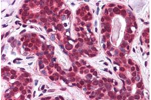Human Breast: Formalin-Fixed, Paraffin-Embedded (FFPE) (SLC5A6 antibody  (N-Term))