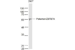 293T lysates probed with PokemonZBTB7A Polyclonal Antibody, Unconjugated  at 1:500 dilution and 4˚C overnight incubation. (ZBTB7A antibody  (AA 151-250))