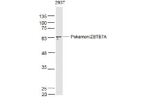 293T lysates probed with PokemonZBTB7A Polyclonal Antibody, Unconjugated  at 1:500 dilution and 4˚C overnight incubation. (ZBTB7A antibody  (AA 151-250))