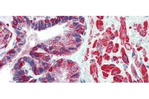 Rabbit Anti-KIF13B Antibody  arp33926 Paraffin Embedded Tissue: Human Prostate Antibody Concentration: 5 ug/ml