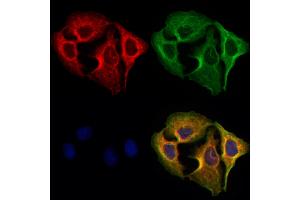 ABIN6265416 and ABIN6273079 staining Hela cells by IF/ICC. (SYVN1 antibody  (Internal Region))