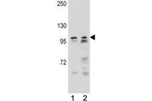 Western Blotting (WB) image for anti-Androgen Receptor (AR) (AA 282-309) antibody (ABIN3029942)