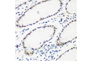 Immunohistochemistry (IHC) image for anti-HIV-1 Tat Specific Factor 1 (HTATSF1) (AA 1-270) antibody (ABIN6142065)