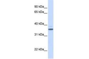 Image no. 1 for anti-Vitamin D-Binding Protein (GC) (AA 216-265) antibody (ABIN6744222) (Vitamin D-Binding Protein antibody  (AA 216-265))