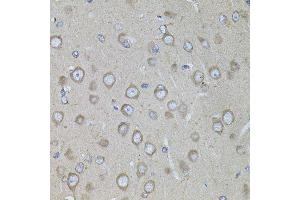 Immunohistochemistry of paraffin-embedded rat brain using CRHR1 antibody. (CRHR1 antibody  (AA 24-120))